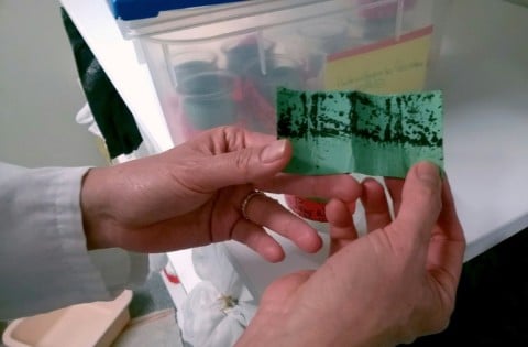 Failloux studied the Wuchereria bancrofti bacteria at university in France