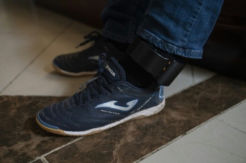 José Contreras, 30, shows the ankle monitor that was placed on him after being brought back from Honduras, at his home in Edinburg, Texas