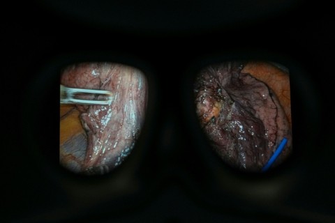 The government has set a target for robotic assistance to be used in 9 out of 10 keyhole surgeries in England by 2035