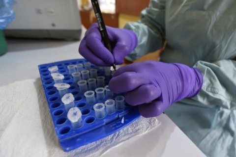 A health official works at the Lassa Fever Research and Control in Irrua Specialist Teaching Hospital in midwest Nigeria, in 2018