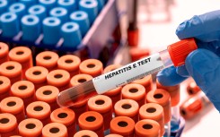 File: A Hepatitis blood test. (WLADIMIR BULGAR/SCIENCE PHOTO LI / WBU / Science Photo Library via AFP)
