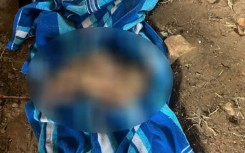 The newborn is recovering in hospital after the ordeal.