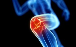 File: An illustration of a runner's knee. AFP/Sebastian Kaulitzki/Science Photo Library