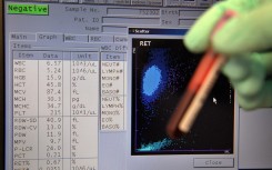 File: Swiss Laboratory for Doping Analysis' Neil Robinson displays the results of a blood sample test. AFP/Fabrice Coffrini