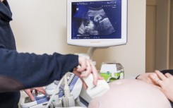 File: A doctor doing an ultrasound examination of a pregnant woman. Jasper Jacobs/Belga/AFP