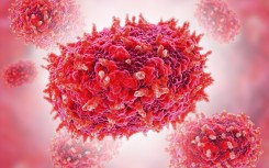 File: Mpox (previously monkeypox) virus particles. SIA/Science Photo Library via AFP