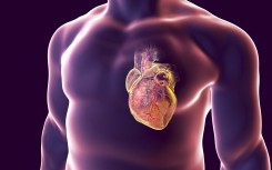 Sudden strokes change thousands of lives. KKO/Science Photo Library via AFP