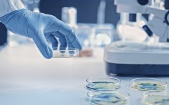 File: Scientist culturing bacteria in petri dishes in a laboratory. GPR/Science Photo Library via AFP