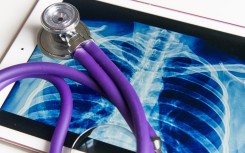 File: An X-Ray on a tablet with a stethoscope. Hans Lucas via AFP/Riccardo Milani