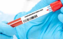 Chikungunya virus test