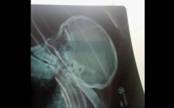 The pupil's X-Ray showing the knife.