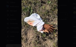 Fake severed hands found in field