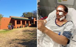 Kameeldrift hoewe aanval