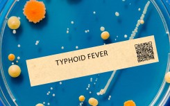 Typhoid fever. This is a bacterial infection that causes fever, abdominal pain, and diarrhoea. PhotoPhoto by WLADIMIR BULGAR/SCIENCE PHOTO LI / WBU / SCIENCE PHOTO LIBRARY VIA AFP 