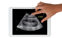 Conceptual image of a kidney disease diagnosis. SAMUNELLA/Science Photo Library via AFP