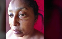 Alida Dudley was allegedly assaulted by police officers.