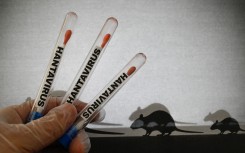 Hantavirus 3
