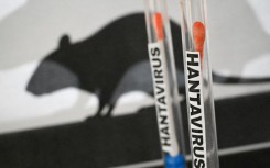 File: Illustration of a hantavirus testing concept. Joao Luiz Bulcao/Hans Lucas via AFP 