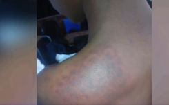 Erasmus Monareng School Assault