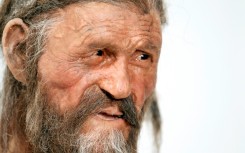 Scientists had previously thought the iceman's skin had darkened in the ice
