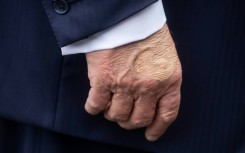 US President Donald Trump's right hand is bruised due to shaking hands and taking aspirin, the White House says