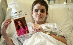 Bazzi's daughter Aseel shows a portrait of herself taken before she was gravely wounded in the Israeli strike