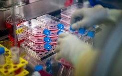 A long rehabilitation process follows the complex graft procedure