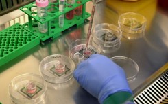 Each so-called 'biological computer' contains around 200,000 living human brain cells